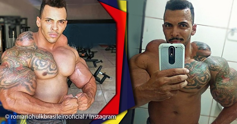 Man got muscles with strange shapes after wanting to be a bodybuilder in the "fast" way